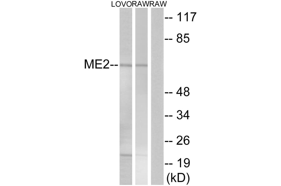Western Blot - Anti-ME2 Antibody (C16813) - Antibodies.com