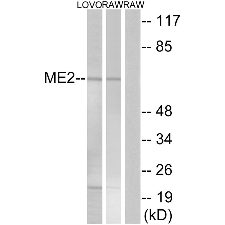 Western Blot - Anti-ME2 Antibody (C16813) - Antibodies.com