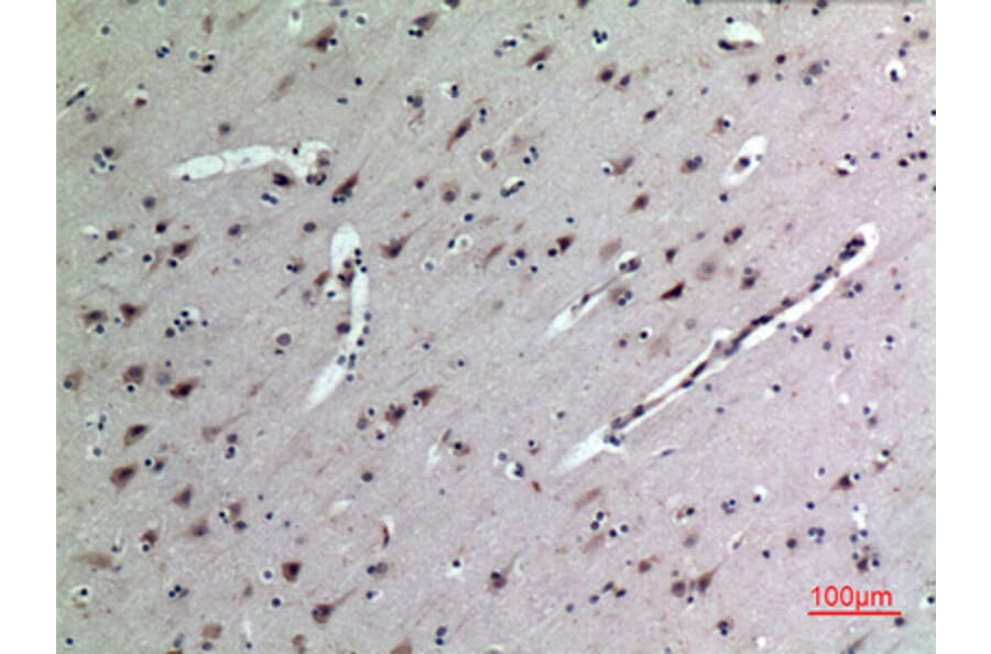 Immunohistochemistry - Anti-MDK Antibody (C30098) - Antibodies.com