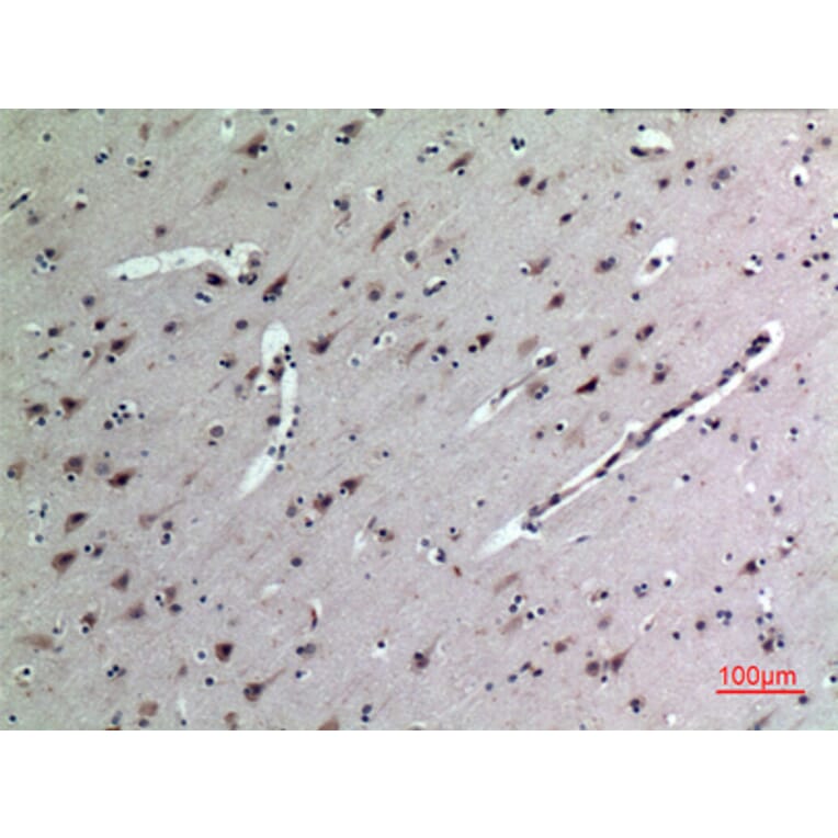 Immunohistochemistry - Anti-MDK Antibody (C30098) - Antibodies.com