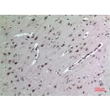 Immunohistochemistry - Anti-MDK Antibody (C30098) - Antibodies.com