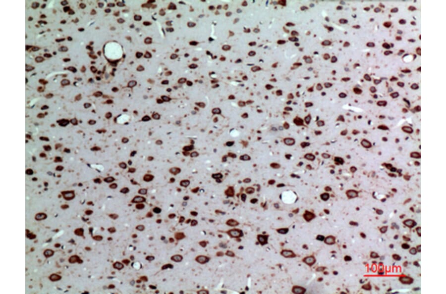 Immunohistochemistry - Anti-MDK Antibody (C30098) - Antibodies.com
