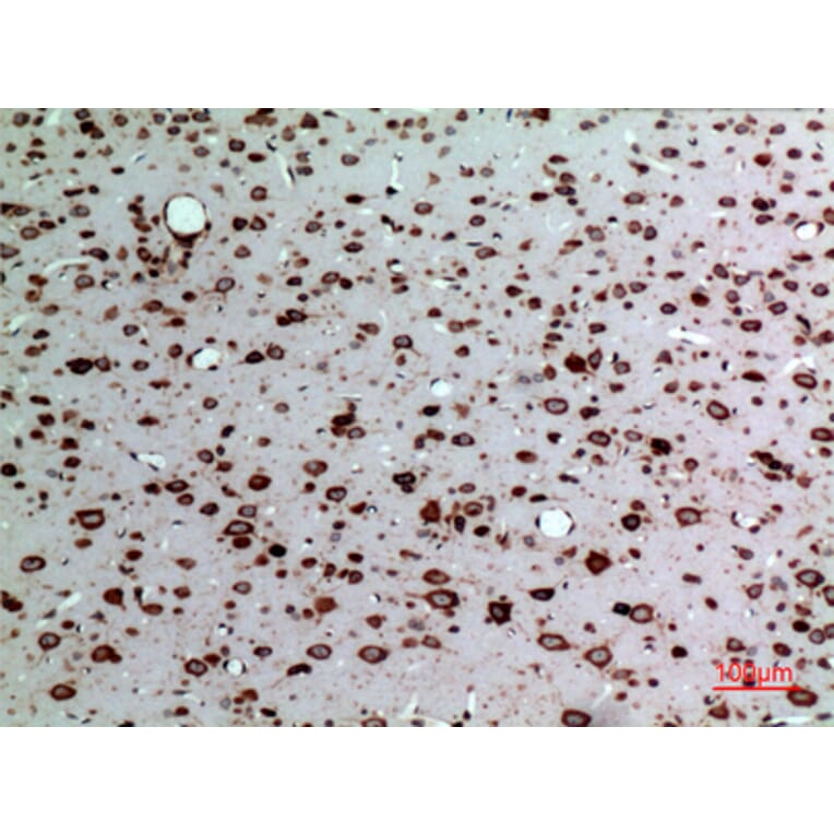 Immunohistochemistry - Anti-MDK Antibody (C30098) - Antibodies.com