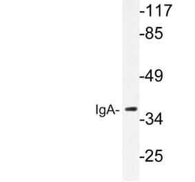 Western Blot - Anti-IgA Antibody (R12-2194) - Antibodies.com