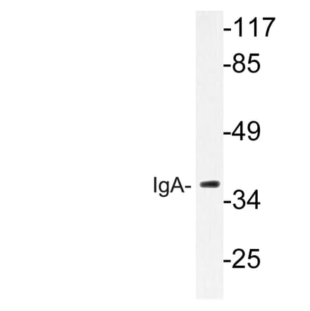 Western Blot - Anti-IgA Antibody (R12-2194) - Antibodies.com