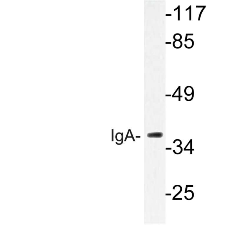 Western Blot - Anti-IgA Antibody (R12-2194) - Antibodies.com
