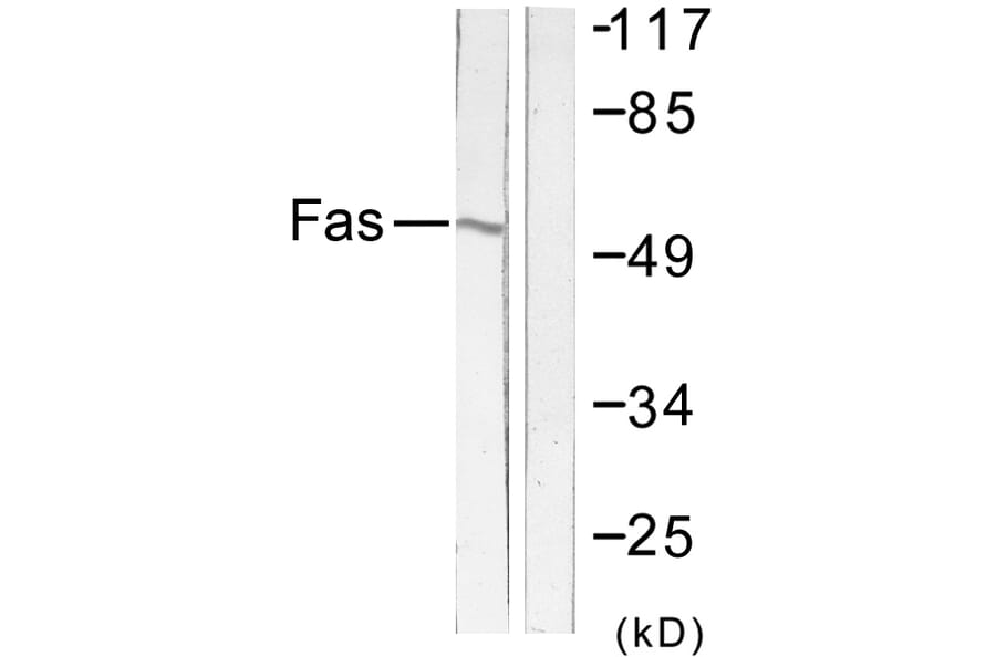 Western Blot - Anti-FAS Antibody (C0355) - Antibodies.com