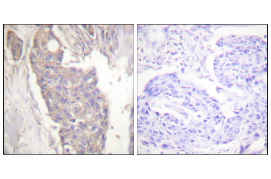 Immunohistochemistry - Anti-FAS Antibody (C0355) - Antibodies.com