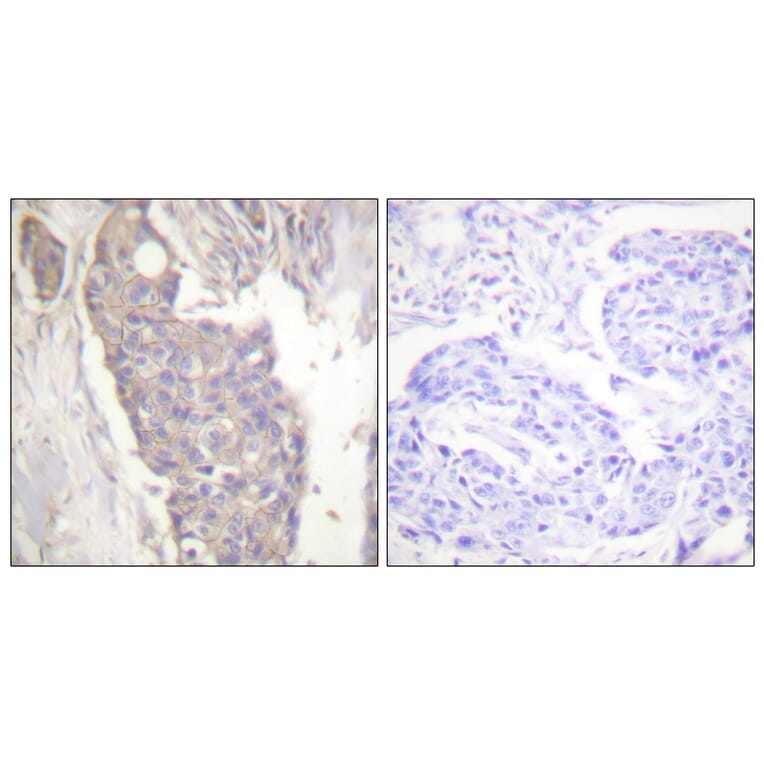 Immunohistochemistry - Anti-FAS Antibody (C0355) - Antibodies.com