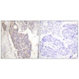 Immunohistochemistry - Anti-FAS Antibody (C0355) - Antibodies.com