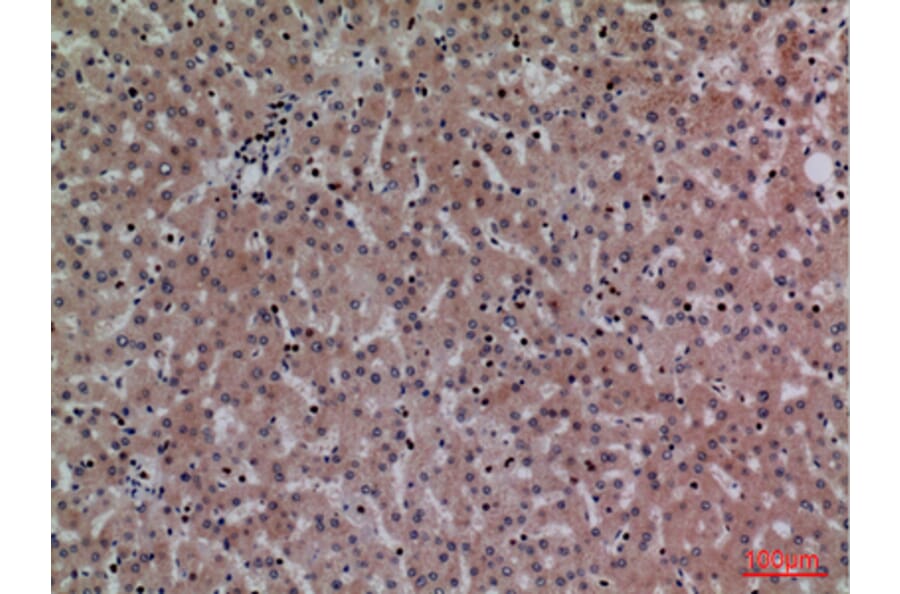 Immunohistochemistry - Anti-CRP Antibody (C30134) - Antibodies.com