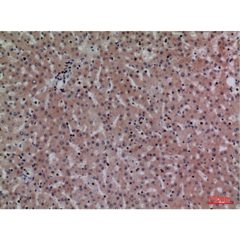 Immunohistochemistry - Anti-CRP Antibody (C30134) - Antibodies.com