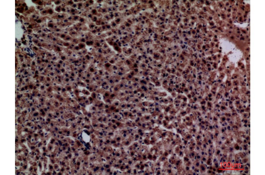 Immunohistochemistry - Anti-CRP Antibody (C30134) - Antibodies.com