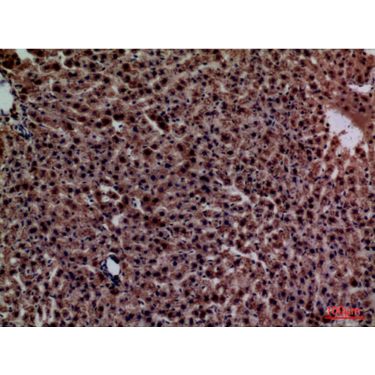 Immunohistochemistry - Anti-CRP Antibody (C30134) - Antibodies.com