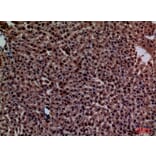 Immunohistochemistry - Anti-CRP Antibody (C30134) - Antibodies.com