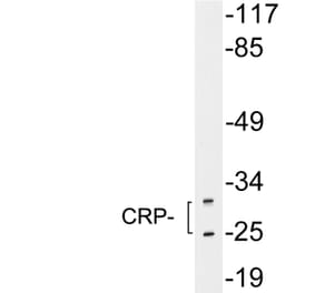 Western Blot - Anti-CRP Antibody (R12-2104) - Antibodies.com