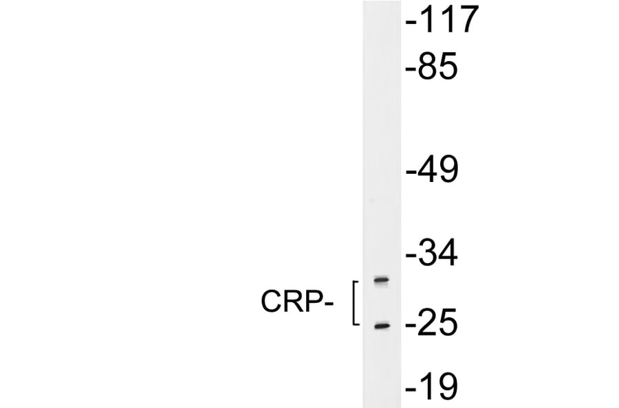 Western Blot - Anti-CRP Antibody (R12-2104) - Antibodies.com