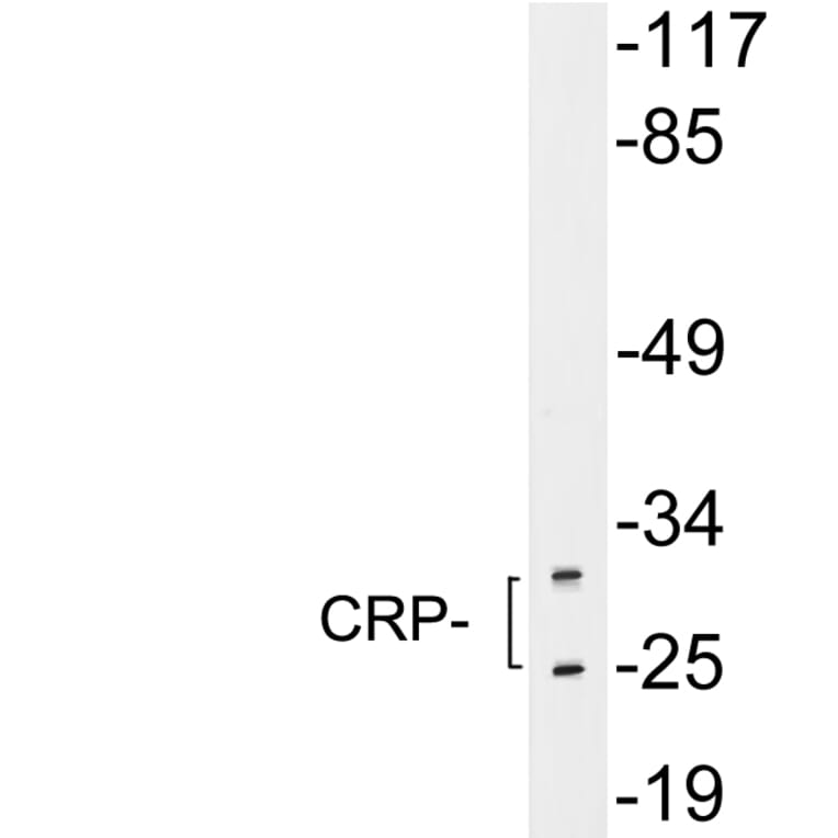 Western Blot - Anti-CRP Antibody (R12-2104) - Antibodies.com