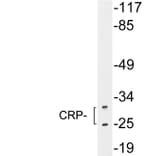 Western Blot - Anti-CRP Antibody (R12-2104) - Antibodies.com