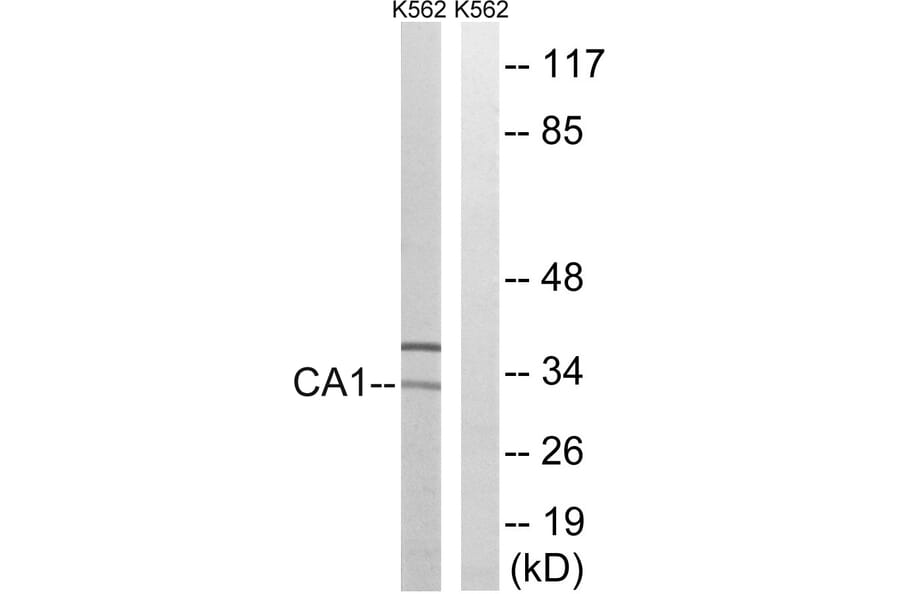 Western Blot - Anti-CA1 Antibody (C14934) - Antibodies.com