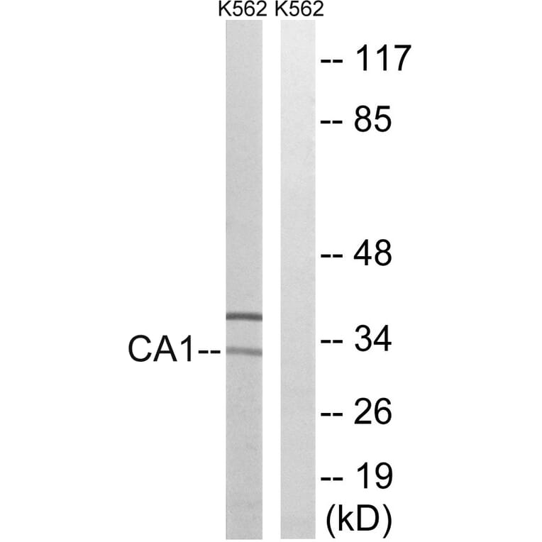 Western Blot - Anti-CA1 Antibody (C14934) - Antibodies.com
