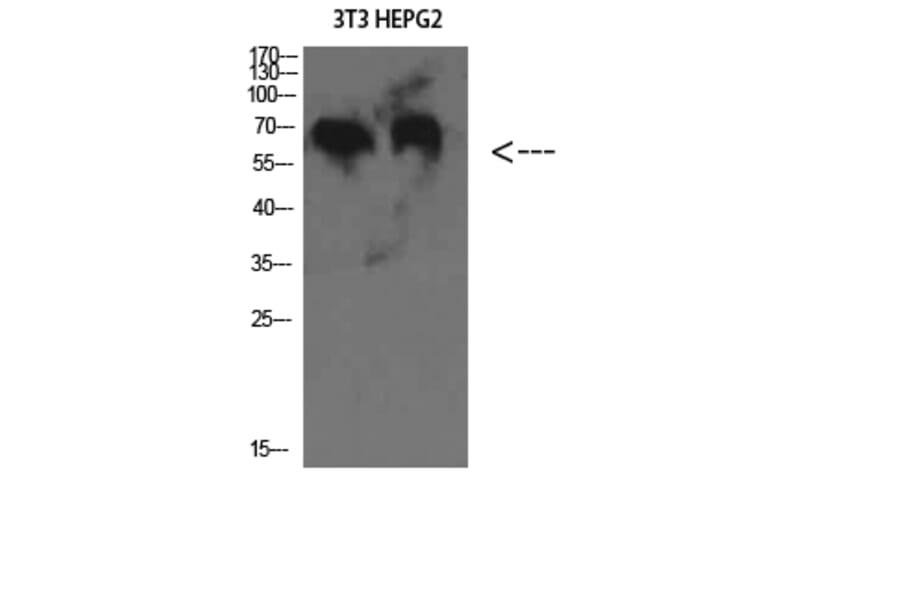 Western Blot - Anti-C8B Antibody (C31006) - Antibodies.com