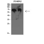 Western Blot - Anti-C8B Antibody (C31006) - Antibodies.com