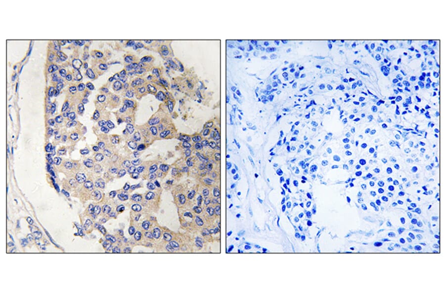 Immunohistochemistry - Anti-C1S Antibody (C15211) - Antibodies.com