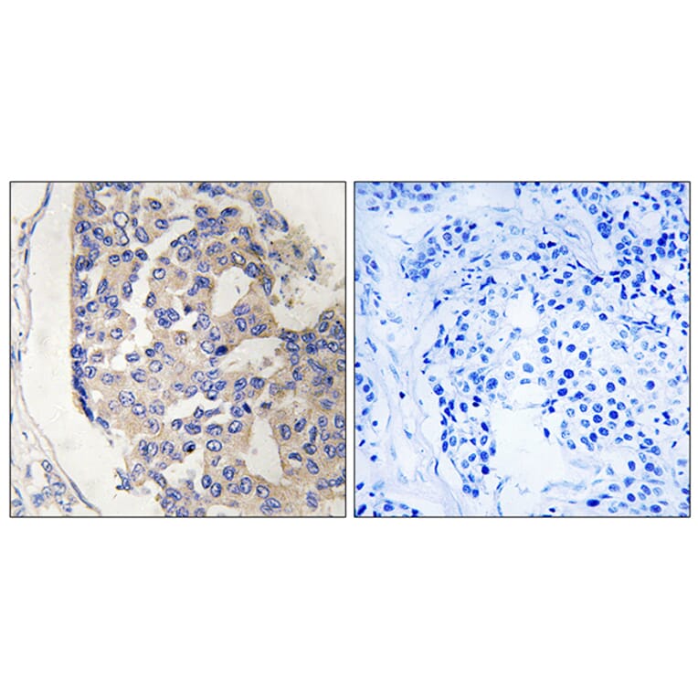 Immunohistochemistry - Anti-C1S Antibody (C15211) - Antibodies.com