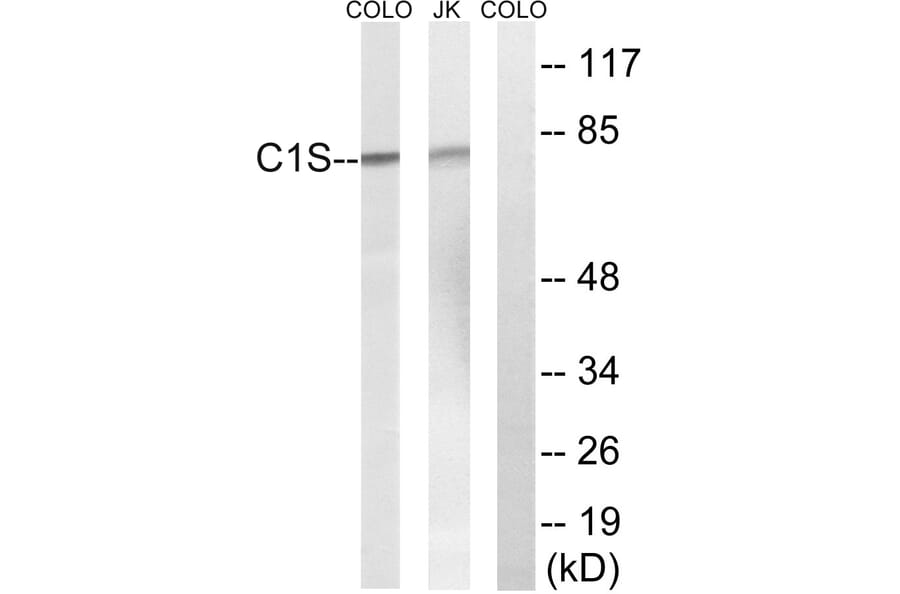 Western Blot - Anti-C1S Antibody (C15211) - Antibodies.com