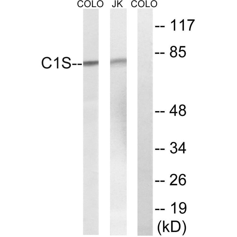 Western Blot - Anti-C1S Antibody (C15211) - Antibodies.com