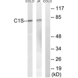 Western Blot - Anti-C1S Antibody (C15211) - Antibodies.com