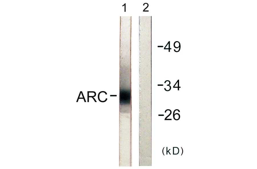 Western Blot - Anti-ARC Antibody (C0130) - Antibodies.com