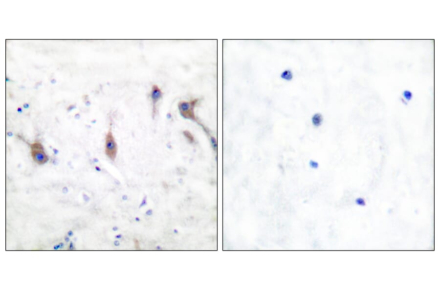 Immunohistochemistry - Anti-ARC Antibody (C0130) - Antibodies.com
