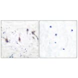 Immunohistochemistry - Anti-ARC Antibody (C0130) - Antibodies.com