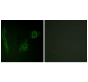 Immunofluorescence - Anti-ALK Antibody (B0612) - Antibodies.com