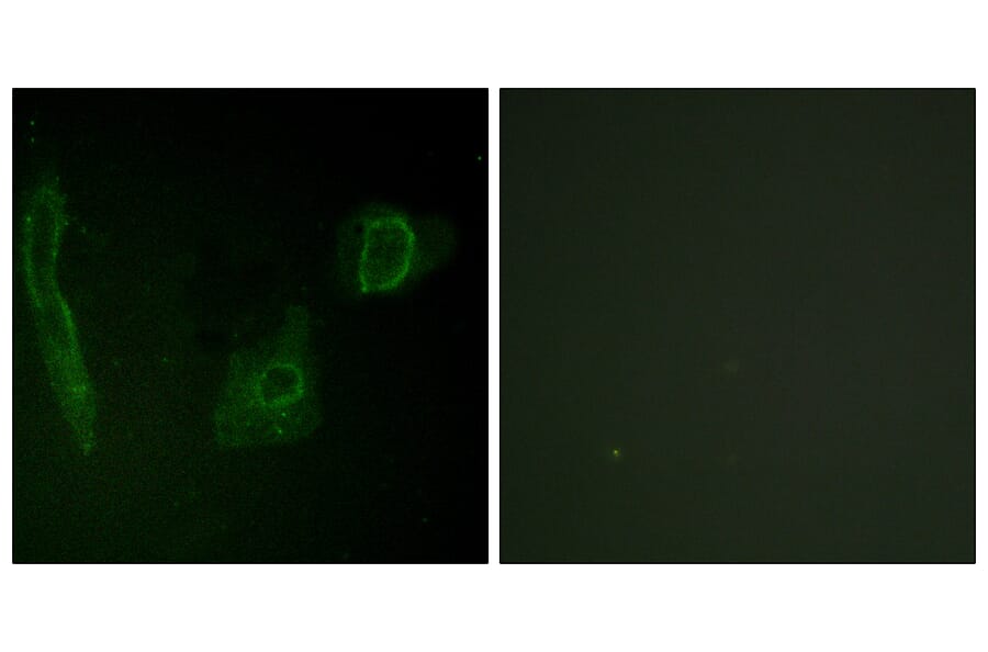 Immunofluorescence - Anti-ALK Antibody (B0612) - Antibodies.com