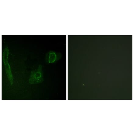 Immunofluorescence - Anti-ALK Antibody (B0612) - Antibodies.com
