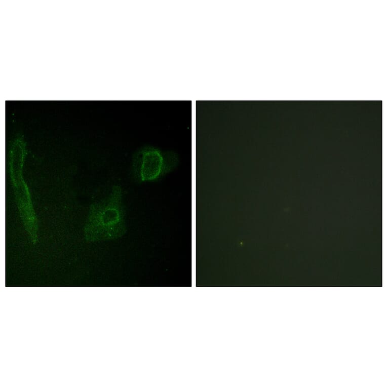 Immunofluorescence - Anti-ALK Antibody (B0612) - Antibodies.com