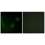 Immunofluorescence - Anti-ALK Antibody (B0612) - Antibodies.com