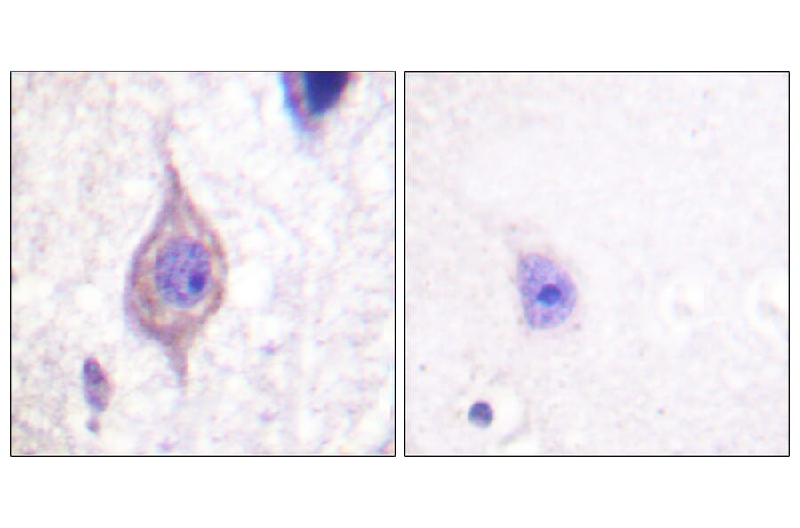 Immunohistochemistry - Anti-ALK Antibody (B0612) - Antibodies.com