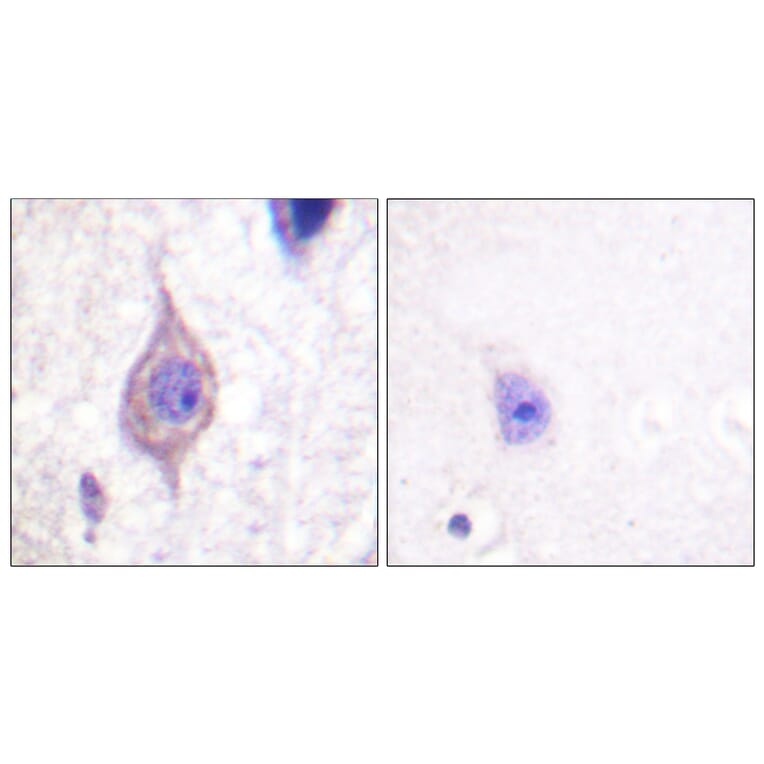 Immunohistochemistry - Anti-ALK Antibody (B0612) - Antibodies.com