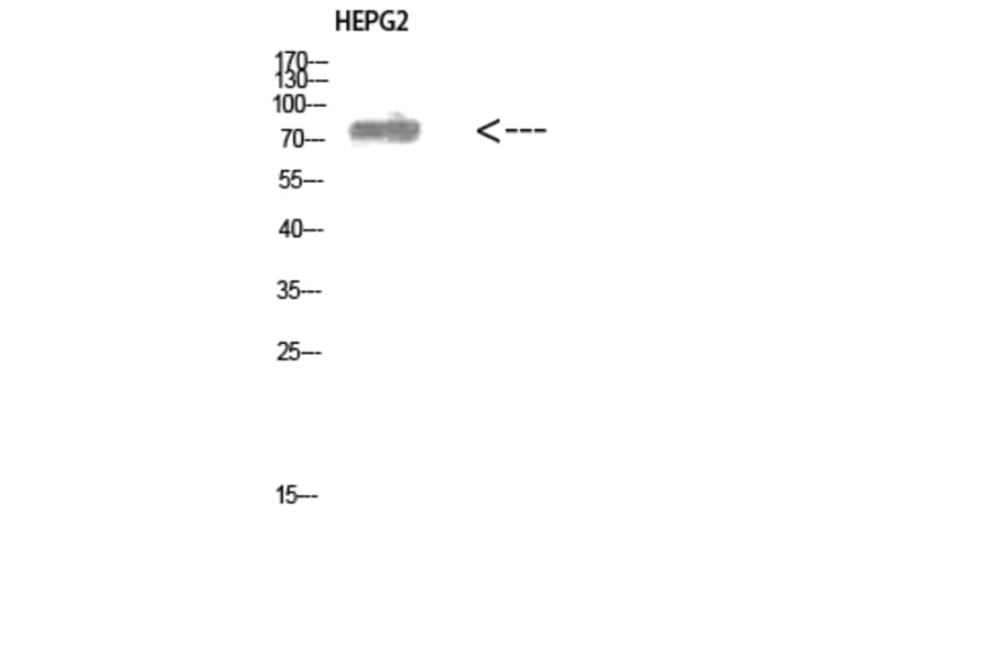 Western Blot - Anti-ALB Antibody (C30864) - Antibodies.com