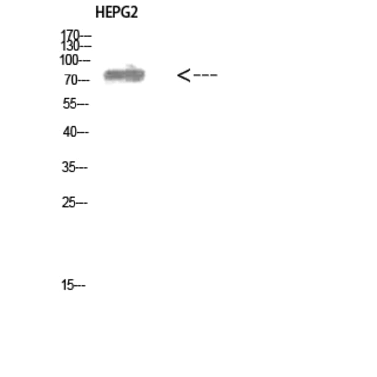 Western Blot - Anti-ALB Antibody (C30864) - Antibodies.com