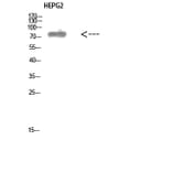 Western Blot - Anti-ALB Antibody (C30864) - Antibodies.com