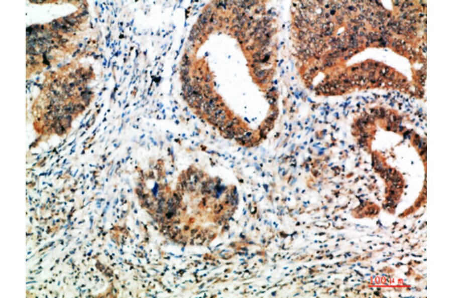 Immunohistochemistry - Anti-ALB Antibody (C30864) - Antibodies.com
