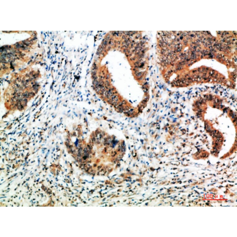 Immunohistochemistry - Anti-ALB Antibody (C30864) - Antibodies.com