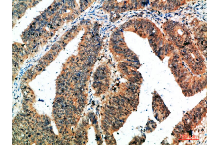 Immunohistochemistry - Anti-ALB Antibody (C30864) - Antibodies.com