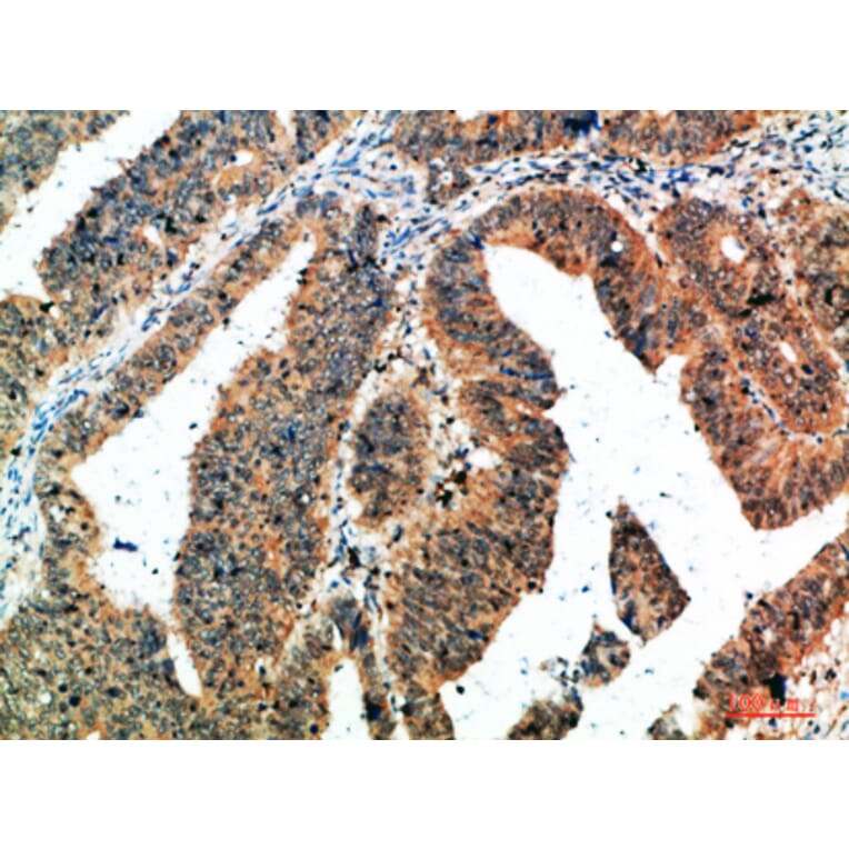 Immunohistochemistry - Anti-ALB Antibody (C30864) - Antibodies.com