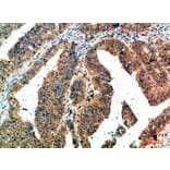 Immunohistochemistry - Anti-ALB Antibody (C30864) - Antibodies.com